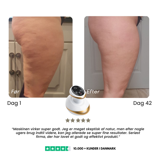 CelluSmooth™ - Anti cellulite massageapparat