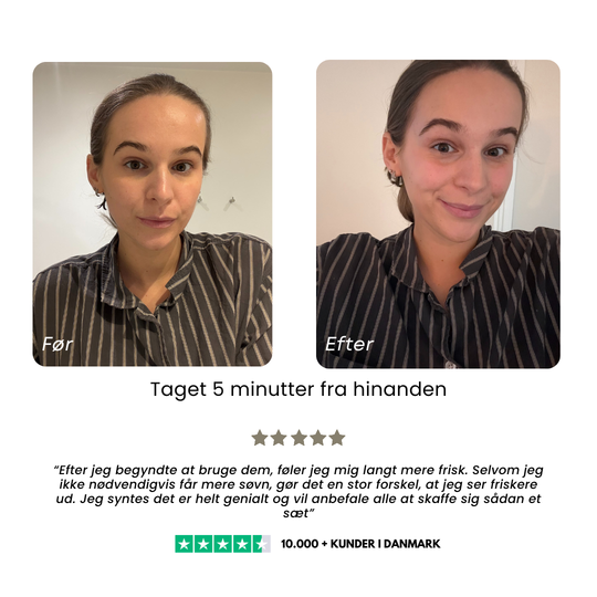 Facial Cupping - Ansigtskopper