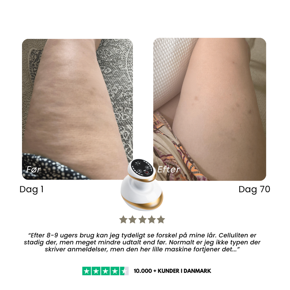 CelluSmooth™ Bundle